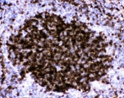 IHC-P: CD23 antibody testing of mouse spleen tissue. HIER: steam section in pH6 citrate buffer for 20 min.