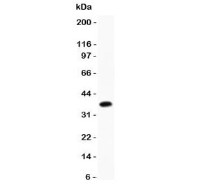 Western blot testing of CD23 antibody and mouse liver lysate. Expected size 37~45KD