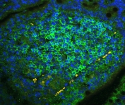 Immunofluorescent staining of FFPE mouse lymph tissue with CD23 antibody (green) at 1ug/ml and DAPI nuclear stain (blue). HIER: steam section in pH6 citrate buffer for 20 min.