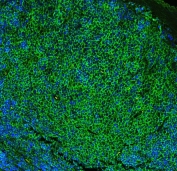 Immunofluorescent staining of FFPE rat lymph tissue with CD23 antibody (green) at 1ug/ml and DAPI nuclear stain (blue). HIER: steam section in pH6 citrate buffer for 20 min.