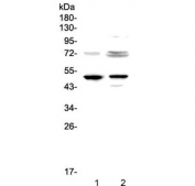 Western blot testing of CD23 antibody and 1) rat spleen and 2) rat thymus lysate.  Expected molecular weight: 37~45 kDa.