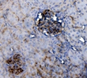 IHC staining of FFPE rat kidney with CD34 antibody. HIER: boil tissue sections in pH8 EDTA for 20 min and allow to cool before testing.