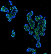 Immunofluorescent staining of FFPE human placenta with CD34 antibody (green) and DAPI nuclear stain (blue). HIER: boil tissue sections in pH8 EDTA for 20 min and allow to cool before testing.