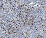 IHC staining of FFPE human spleen tissue with MPO antibody. HIER: boil tissue sections in pH8 EDTA for 20 min and allow to cool before testing.