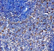 IHC staining of FFPE rat spleen tissue with CCL4 antibody. HIER: boil tissue sections in pH8 EDTA for 20 min and allow to cool before testing.