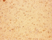 IHC-P: CNTF antibody testing of mouse brain tissue