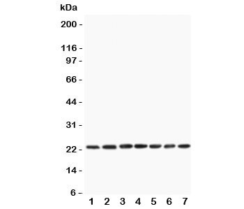 Western blot testing of CNTF antibody and rat samples 1: PC12; 2: NRK; 3: RH35; 4: brain; 5: liver; 6: spleen; 7: testis lysate. Expected/observed size ~23KD
