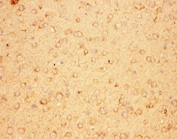 IHC-P: CNTF antibody testing of mouse brain tissue