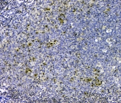 IHC staining of FFPE human tonsil with p27KIP1 antibody at 1ug/ml. HIER: boil tissue sections in pH6, 10mM citrate buffer, for 10-20 min and allow to cool before testing.