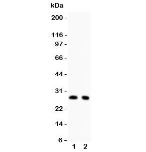 Western blot testing of p27KIP1 antibody and Lane 1: rat thymus; 2: rat brain lysate. Expected/observed size ~27KD