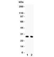 Western blot testing of p27KIP1 antibody and Lane 1:  rat thymus;  2: rat brain lysate.  Expected/observed molecular weight ~27 kDa.