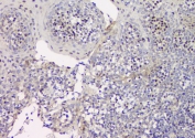 IHC staining of FFPE human tonsil with p27KIP1 antibody at 1ug/ml. HIER: boil tissue sections in pH6, 10mM citrate buffer, for 10-20 min and allow to cool before testing.