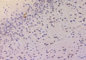 IHC staining of FFPE rat brain with p27KIP1 antibody at 1ug/ml. HIER: boil tissue sections in pH6, 10mM citrate buffer, for 10-20 min and allow to cool before testing.