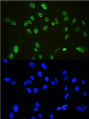 ICC staining of FFPE human U-2 OS cells with p27KIP1 antibody (green) at 2ug/ml and DAPI nuclear stain (blue). HIER: steam section in pH6 citrate buffer for 20 min.