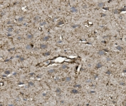 IHC staining of FFPE rat brain with VEGF antibody. HIER: boil tissue sections in pH6, 10mM citrate buffer, for 20 min and allow to cool before testing.