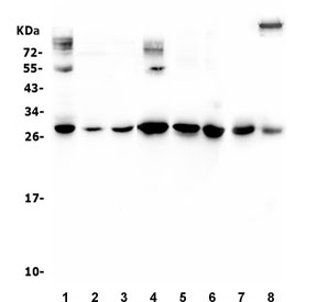 Western blot testing of 1) rat lung, 2) rat liver, 3) rat thymus, 4) mouse lung, 5) mouse thymus, 6) mouse HEPA1-6, 7) human placenta and 8) human A431 lysate with VEGF antibody. Predicted molecular weight 19~22 kDa (monomer) and 38~44 kDa (dimer).