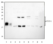 Western blot testing of 1) rat lung, 2) rat liver, 3) rat thymus, 4) mouse lung, 5) mouse thymus, 6) mouse HEPA1-6, 7) human placenta and 8) human A431 lysate with VEGF antibody. Predicted molecular weight 19~22 kDa (monomer) and 38~44 kDa (dimer).