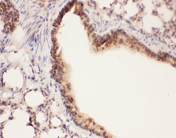 IHC-P: ALOX15 antibody testing of mouse lung tissue