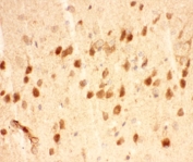 IHC-P testing of mouse brain tissue. HIER: steam section in pH6 citrate buffer for 20 min and allow to cool prior to staining.