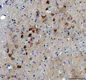 IHC-P testing of mouse brain tissue. HIER: steam section in pH6 citrate buffer for 20 min and allow to cool prior to staining.