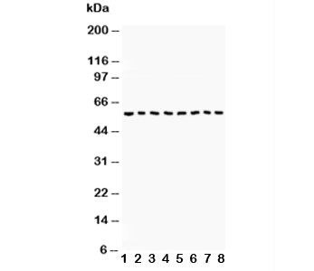Western blot testing of Beclin 1 antibody and Lane 1: COLO320; 2: HepG2; 3: PANC; 4: A431; 5: SMMC-7721; 6: Jurkat; 7: SW620; 8: U87 lysate. Expected size: 49KD, Observed size: ~57KD
