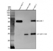 Immunoprecipitation of Beclin 1 protein from 500ug of human MCF7 whole cell lysate with 2ug of Beclin 1 antibody.