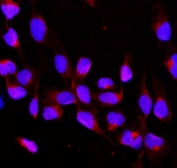Immunofluorescent staining of FFPE human U-2 OS cells with CBL antibody. HIER: boil tissue sections in pH6, 10mM citrate buffer, for 20 min and allow to cool before testing.