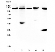 Western blot testing of human 1) HL60, 2) K562, 3) Raji, 4) PC-12 and 5) Ana-1 cell lysate with CBL antibody. Expected molecular weight: 100-120 kDa.