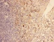 IHC-P: CXCR3 antibody testing of human tonsil tissue