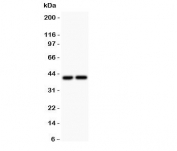 Western blot testing of CXCR3 antibody and Lane 1:  COLO320;  2: SGC lysate.  Predicted molecular weight ~41 kDa.