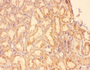 IHC-P: CXCR3 antibody testing of rat kidney tissue