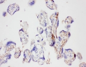 IHC-P: Galectin 3 antibody testing of human placenta tissue. HIER: steam section in pH6 citrate buffer for 20 min.