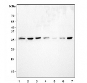 Western blot testing of human 1) HeLa, 2) SiHa, 3) U-87 MG, 4) RT4, 5) HaCaT, 6) PC-3 and 7) T-47D cell lysate with Galectin 3 antibody. Predicted molecular weight ~26 kDa.