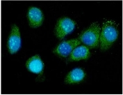 Immunofluorescent staining of FFPE human SiHa cells with Galectin 3 antibody (green) at and DAPI nuclear stain (blue). HIER: steam section in pH6 citrate buffer for 20 min.
