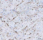 IHC staining of FFPE mouse brain tissue with GFAP antibody. HIER: boil tissue sections in pH8 EDTA for 20 min and allow to cool before testing.