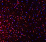 Immunofluorescent staining of FFPE rat brain with GFAP antibody (red) and DAPI nuclear counterstain (blue). HIER: boil tissue sections in pH8 EDTA buffer, for 10-20 min followed by cooling at RT for 20 min.