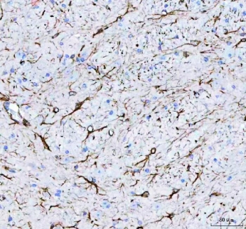 IHC-P: GFAP antibody testing of mouse brain tissue