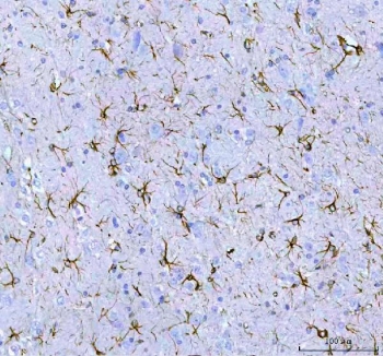 Immunofluorescent staining of FFPE mouse brain with GFAP antibody (red) and DAPI nuclear counterstain (blue). HIER: boil tissue sections in pH6, 10mM citrate buffer, for 10-20 min followed by cooling at RT for 20 min.