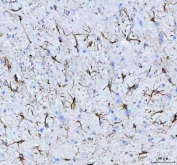 IHC staining of FFPE mouse brain tissue with GFAP antibody. HIER: boil tissue sections in pH8 EDTA for 20 min and allow to cool before testing.