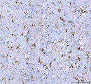 IHC staining of FFPE rat brain tissue with GFAP antibody. HIER: boil tissue sections in pH8 EDTA for 20 min and allow to cool before testing.