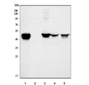 Western blot testing of 1) human U-251 (glioblastoma), 2) human HeLa (cervical), 3) rat brain, 4) rat C6 (glioma) and 5) mouse brain tissue lysate with GFAP antibody. Predicted molecular weight: ~50 kDa.