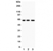 Western blot testing of RELA antibody and human samples 1: Jurkat;  2: COLO320;  3: HeLa lysate. Expected molecular weight ~65 kDa.