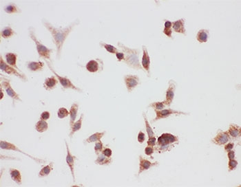 ICC testing of HSP90 antibody and A549 cells