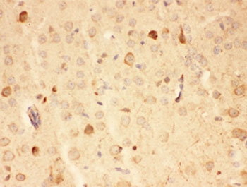 IHC-P: HSP90 antibody testing of mouse brain tissue. HIER: steamed with pH6 citrate buffer.