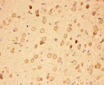 IHC-P: HSP90 antibody testing of rat brain tissue. HIER: steamed with pH6 citrate buffer.