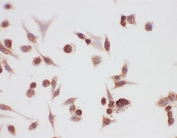 ICC testing of HSP90 alpha antibody and A549 cells
