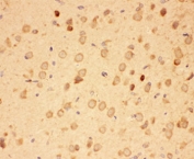 IHC-P: HSP90 alpha antibody testing of rat brain tissue. HIER: steamed with pH6 citrate buffer.