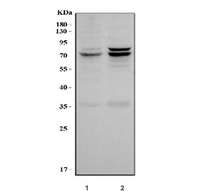 Western blot testing of human 1) HepG2 and 2) HCCT cell lysate with AFP antibody.  Pre