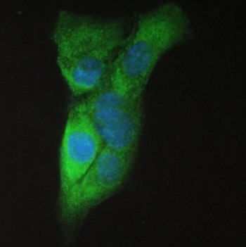 IF/ICC staining of FFPE human A431 cells with Amyloid beta antibody (green) at 2ug/ml and DAPI nuclear stain (blue). HIER: boil tissue sections in pH6, 10mM citrate buffer, for 10-20 min and allow to cool before testing.