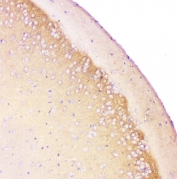IHC staining of FFPE mouse brain with Amyloid beta antibody at 1ug/ml. HIER: boil tissue sections in pH6, 10mM citrate buffer, for 10-20 min and allow to cool before testing.
